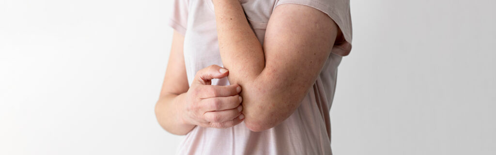 allergies: types, causes, symptoms and treatments