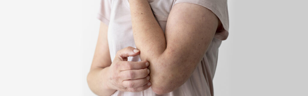 Types of allergies and when allergic reaction become emergency