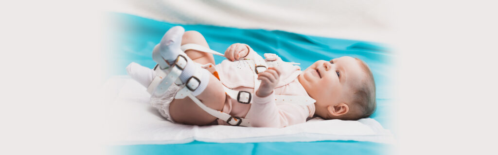 hip dysplasia in children